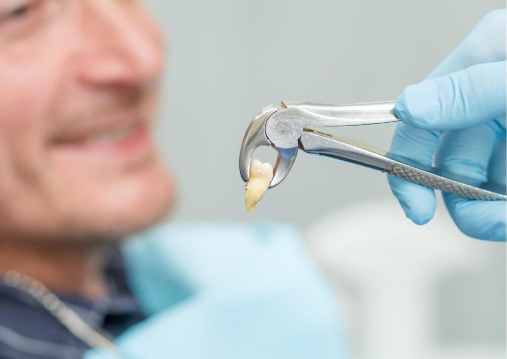 Dentist holding a freshly extracted tooth with forceps, illustrating the tooth extraction process and factors that affect how long it takes to extract a tooth.